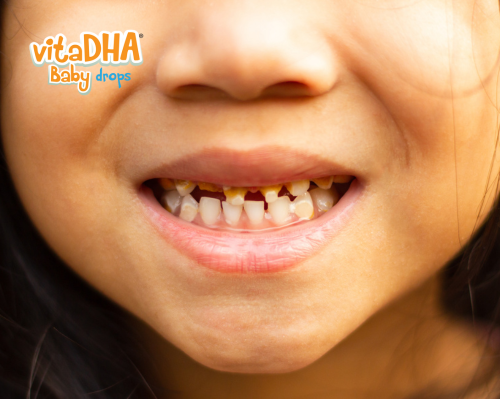Ba mẹ có biết trẻ mọc răng chậm nên bổ sung gì tốt nhất?
