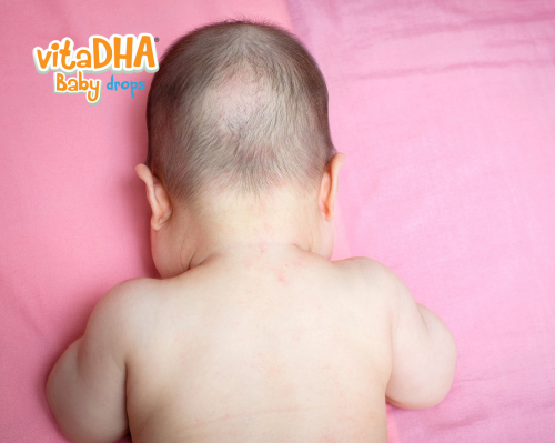 Bé 1 tuổi hay bị rụng tóc ba mẹ nên khắc phục như thế nào?